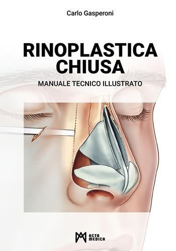 Rinoplastica chiusa. Manuale tecnico illustrato - Carlo Gasperoni - Libro Acta Medica Edizioni 2022 | Libraccio.it