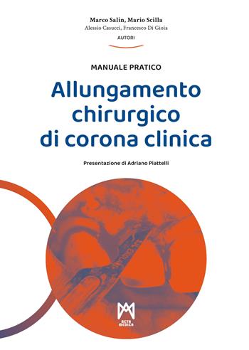 Allungamento chirurgico di corona clinica. Ediz. illustrata - Marco Salin, Mario Scilla, Alessio Casucci - Libro Acta Medica Edizioni 2023 | Libraccio.it