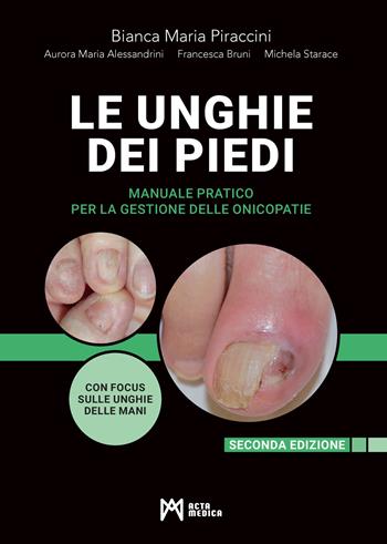 Le unghie dei piedi. Manuale pratico per la gestione delle onicopatie. Ediz. ampliata - Bianca Maria Piraccini, Aurora Maria Alessandrini, Francesca Bruni - Libro Acta Medica Edizioni 2024 | Libraccio.it