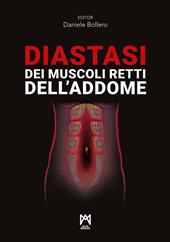 Diastasi dei muscoli retti dell’addome