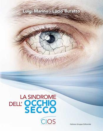 La sindrome dell'occhio secco - Luigi Marino, Lucio Buratto - Libro Fabiano 2016 | Libraccio.it