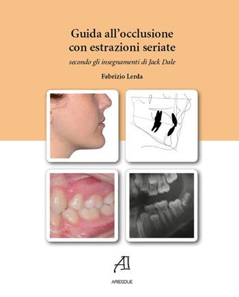 Guida all'occlusione con estrazioni seriate secondo gli insegnamenti di Jack Dale - Fabrizio Lerda - Libro Ariesdue 2019 | Libraccio.it