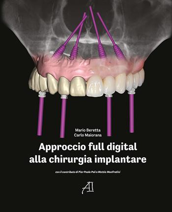 Approccio full digital alla chirurgia implantare - Mario Beretta, Carlo Maiorana - Libro Ariesdue 2023 | Libraccio.it