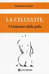 La cellulite. L'alzheimer della pelle