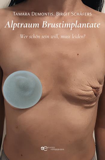 Alptraum Brustimplantate. Wer schön sein will, muss leiden? - Tamara Demontis, Birgit Schäfers - Libro Europa Edizioni 2024, Globus | Libraccio.it