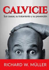 Calvicie. Sus causas, su tratamiento y su prevención