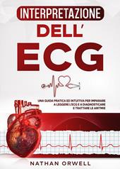 Interpretazione dell'ECG