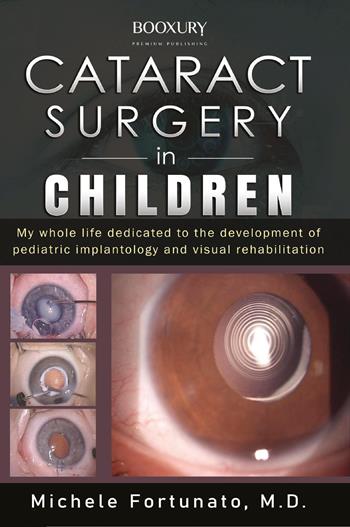 Cataract surgery in children - Michele Fortunato - Libro Youcanprint 2022 | Libraccio.it