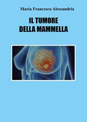 Il tumore della mammella