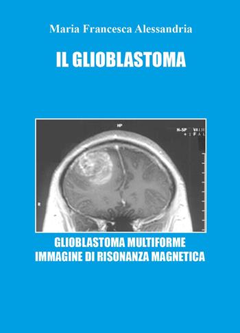Il glioblastoma - Maria Francesca Alessandria - Libro Youcanprint 2023 | Libraccio.it