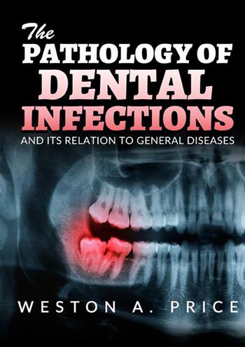 The pathology of dental infections and its relation to general diseases - Weston A. Price - Libro StreetLib 2022 | Libraccio.it