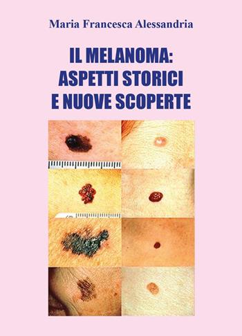 Il melanoma: aspetti storici e nuove scoperte - Maria Francesca Alessandria - Libro Youcanprint 2024 | Libraccio.it