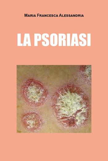 La psoriasi - Maria Francesca Alessandria - Libro Youcanprint 2025 | Libraccio.it