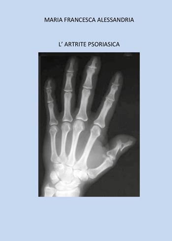 L'artrite psoriasica - Maria Francesca Alessandria - Libro Youcanprint 2025 | Libraccio.it