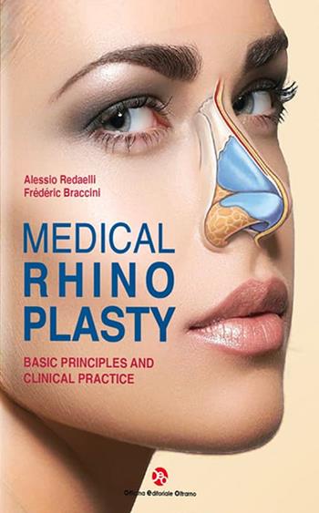 Medical rhinoplasty. Basic principles and clinical practice - Alessio Redaelli, Frederic Braccini - Libro OEO 2022 | Libraccio.it