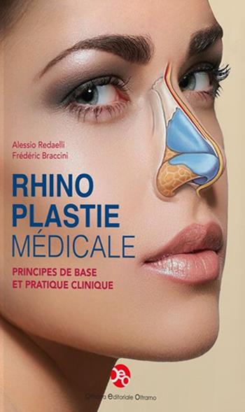 Rhinoplastie médicale. Principes de base et pratique clinique - Frédéric Braccini, Alessio Redaelli - Libro OEO 2025 | Libraccio.it