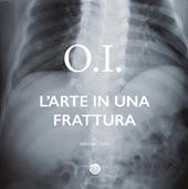 O.I. L'arte in una frattura