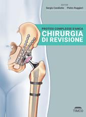 Protesi complesse d'anca. Chirurgia di revisione. Ediz. illustrata