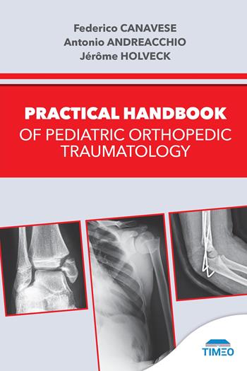 Practical handbook of pediatric orthopedic traumatology - Federico Canavese, Antonio Andreacchio, Jérôme Holveck - Libro Timeo 2025 | Libraccio.it