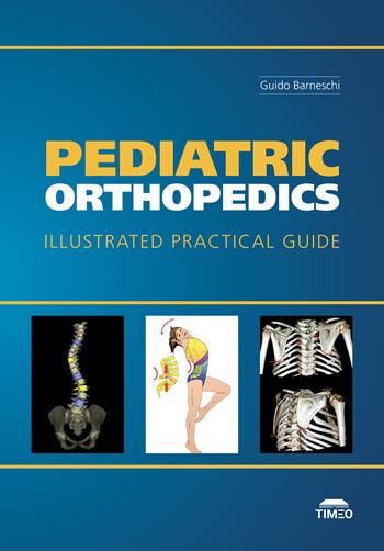 Pediatric Orthopedics. Illustrated Practical Guide. Ediz. illustrata - Guido Barneschi - Libro Timeo 2025 | Libraccio.it