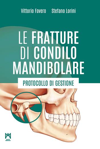 Le fratture di condilo mandibolare. Protocollo di gestione - Vittorio Favero, Stefano Lorini - Libro Acta Medica Edizioni 2026 | Libraccio.it