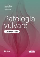 Patologia vulvare. Dermatosi. Ediz. illustrata